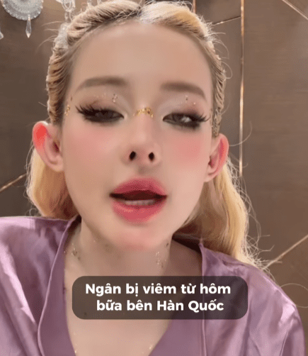 Queen of Aesthetics Ngân 98 Faces Painful Incident, Reveals Next Surgery Plans 2 Ngân 98 meets with a serious accident, revealing her upcoming surgery.