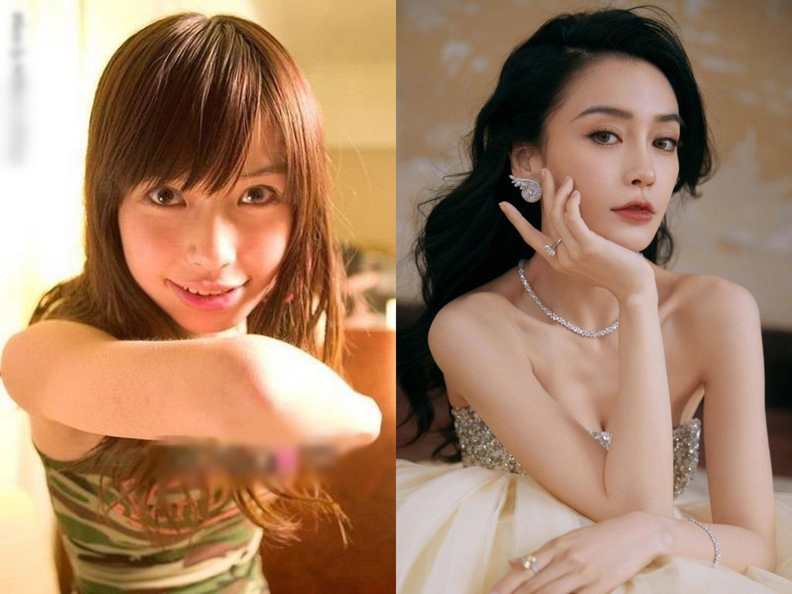 Angelababy has openly embraced her cosmetic procedures, showcasing a remarkable transformation. Angelababy's transformation journey