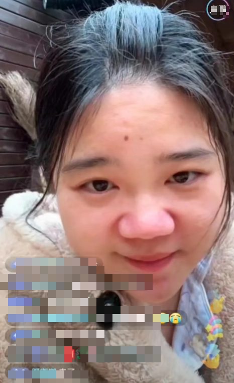 Xue MM Transformation Xue MM Transformation