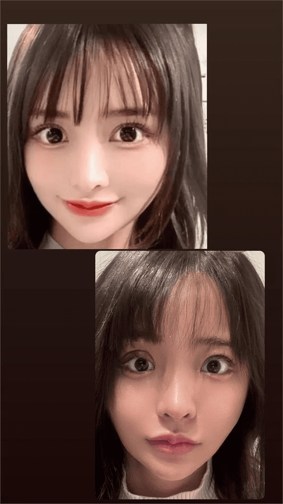 Shirahama Nozomi Surgery Shirahama Nozomi Surgery