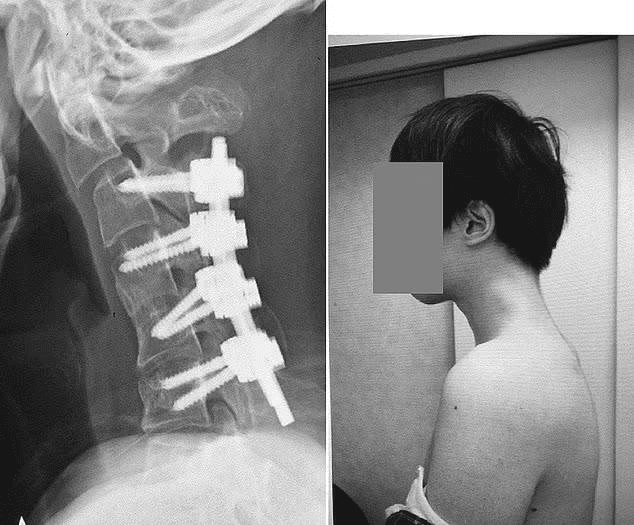 Surgery Image Surgery Image