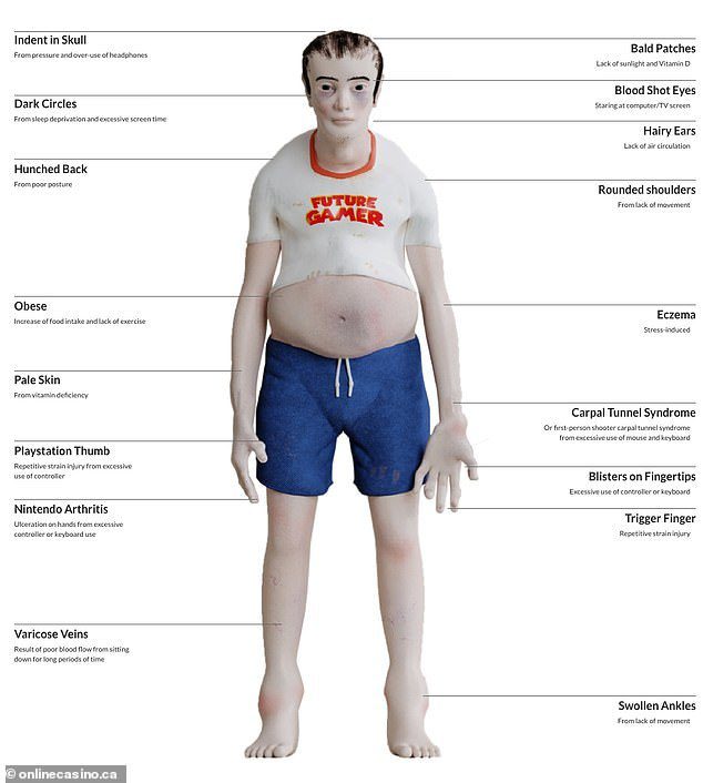 Scary Images of Unscientific Gaming: A Warning for Gamers 2 Health risks associated with excessive gaming, Image 3.