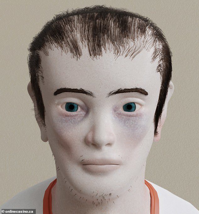 Scary Images of Unscientific Gaming: A Warning for Gamers 3 Health risks associated with excessive gaming, Image 4.