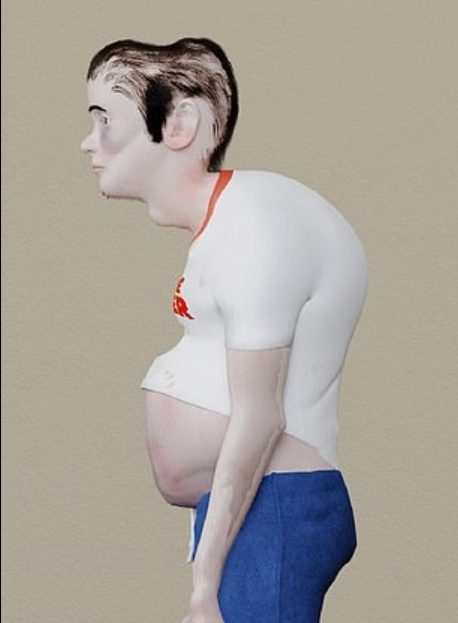 Scary Images of Unscientific Gaming: A Warning for Gamers 5 Health risks associated with excessive gaming, Image 6.