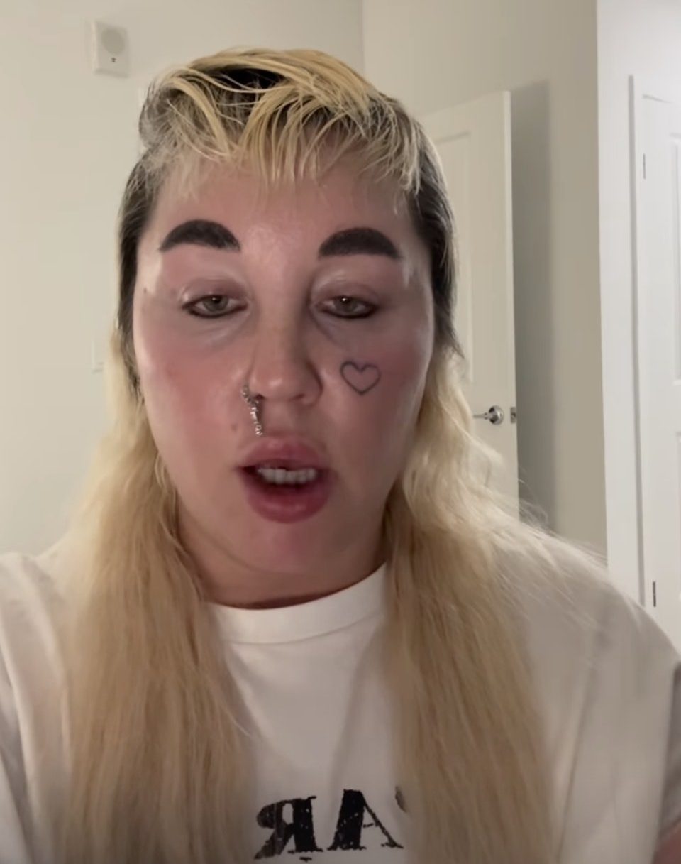 Amanda Bynes' recent condition shocks fans Amanda Bynes' serious appearance