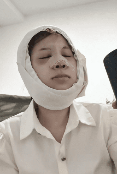 Spending hundreds of millions on beauty restoration, hot TikToker responds to mixed comments 5 ChangMie After Cosmetic Surgery